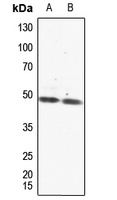 PAR1 Rabbit Polyclonal Antibody