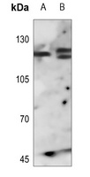 FGFR1 Antibody