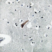GABRA1 Antibody