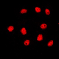 Anti-GATA4 Antibody