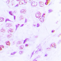 Anti-GCN5 Antibody