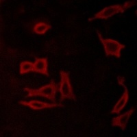 GRM5 antibody