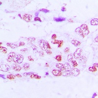 Anti-GSK3 alpha/beta (Phospho-Y279/216) Antibody