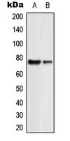 GUCY1B2 Antibody