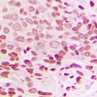 Histone H1.0 Rabbit Polyclonal Antibody