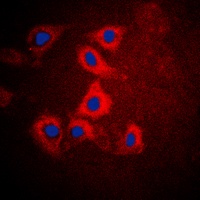 HEXB antibody