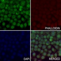 Anti-HIF1 alpha Antibody