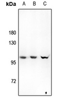 Hexokinase 3 Rabbit Polyclonal Antibody