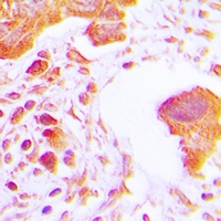 Hexokinase 3 Rabbit Polyclonal Antibody