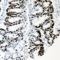 Anti-HNF4 alpha (Phospho-S313) Antibody