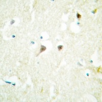Anti-hNRNP C Antibody