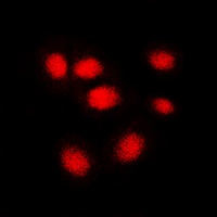 Anti-hNRNP C Antibody