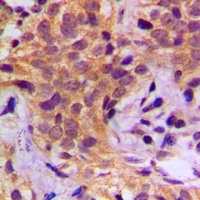 Anti-HSP90 beta (Phospho-S254) Antibody