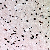 Anti-IL-16 Antibody