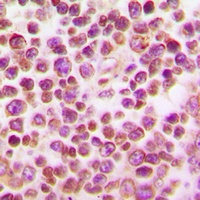 Anti-IRF4 Antibody
