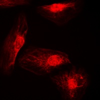 Anti-IRF4 Antibody