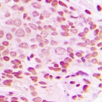 c-Jun (Phospho-T93) Antibody