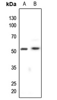 Cytokeratin 8 Rabbit Polyclonal Antibody