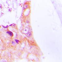 Anti-Cytokeratin 8 Antibody