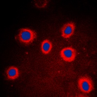 Anti-Cytokeratin 8 Antibody