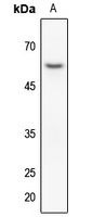Cytokeratin 8 Rabbit Polyclonal Antibody