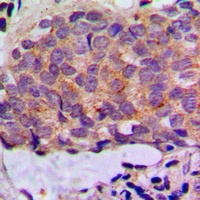 Anti-Cytokeratin 8 Antibody