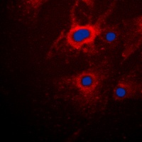 Anti-Cytokeratin 8 Antibody