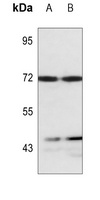LIMK1/2 Antibody