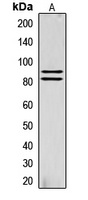 HSL (Phospho-S855) Antibody