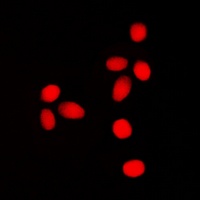 Anti-Lamin A/C (Phospho-S392) Antibody