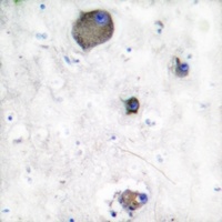 Anti-LYN (Phospho-Y508) Antibody