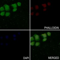 Anti-LYN (Phospho-Y508) Antibody
