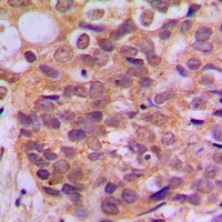SMAD3 (Phospho-S425) Antibody