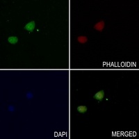TAU (Phospho-S713) Antibody