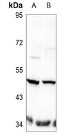 TAU (Phospho-T498) Antibody
