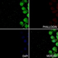 TAU (Phospho-T498) Antibody