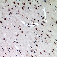 Anti-Midkine Antibody