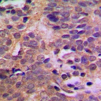 Anti-MDM2 (Phospho-S166) Antibody