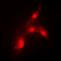 MDM2 antibody