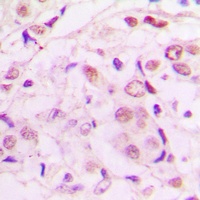 Anti-MEF2A (Phospho-T319) Antibody