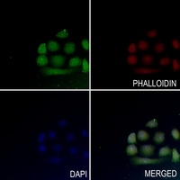 Anti-MEF2A (Phospho-T319) Antibody
