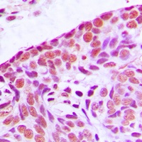 MEKK3 Antibody