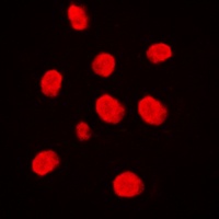 MEKK3 Antibody