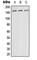 ASK1 Antibody