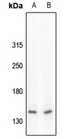 c-Met (Phospho-Y1234) Antibody