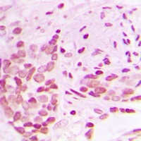 Anti-AF4 Antibody