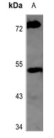 MMP10 Antibody