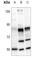 MMP16 Rabbit Polyclonal Antibody