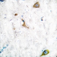 Anti-MMP16 Antibody