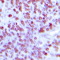 Anti-MNDA Antibody